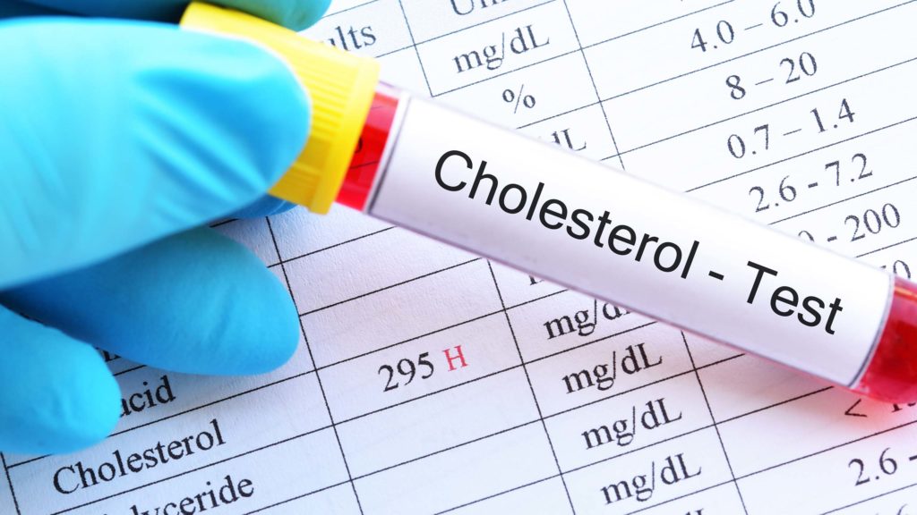 Analisi colesterolo in farmacia